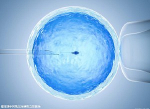 第三代试管婴儿 PGT